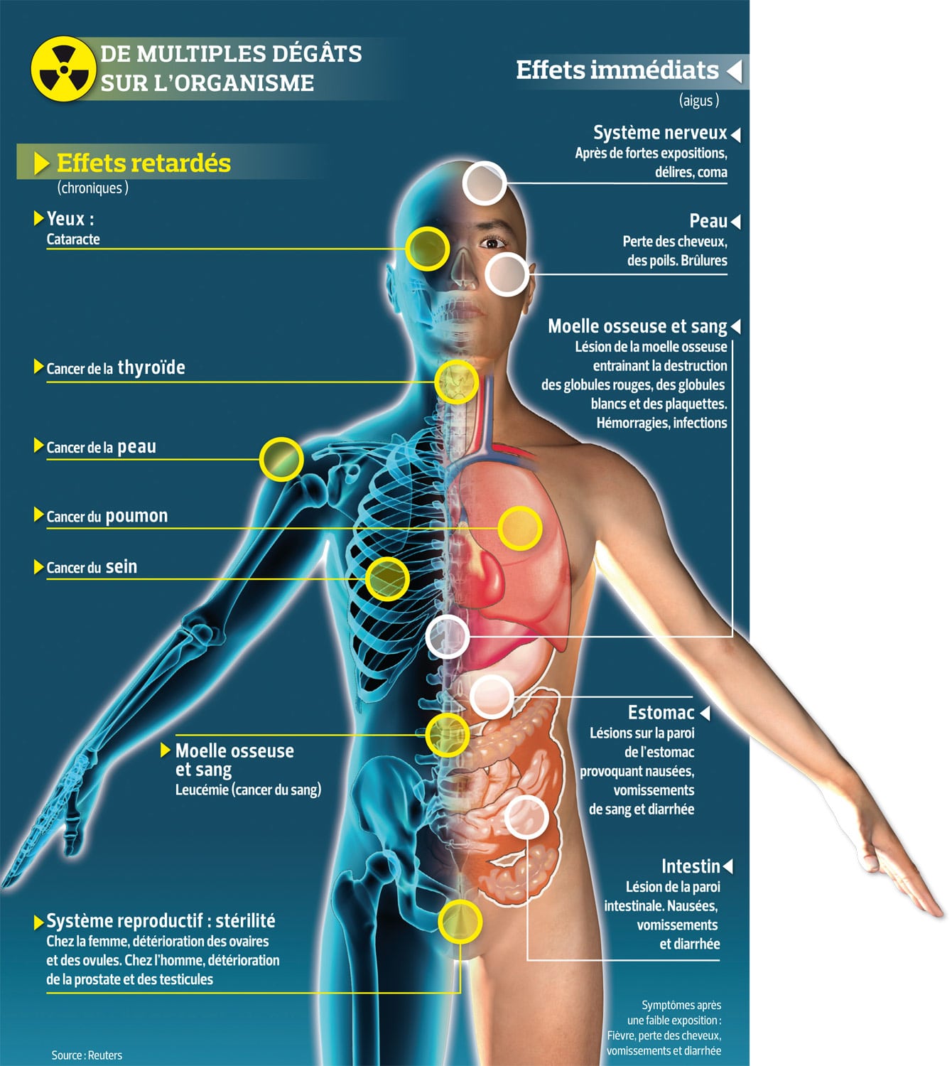 effets des rayonnements ionisants sur l’organisme | NOVA RADIOPROTECTION